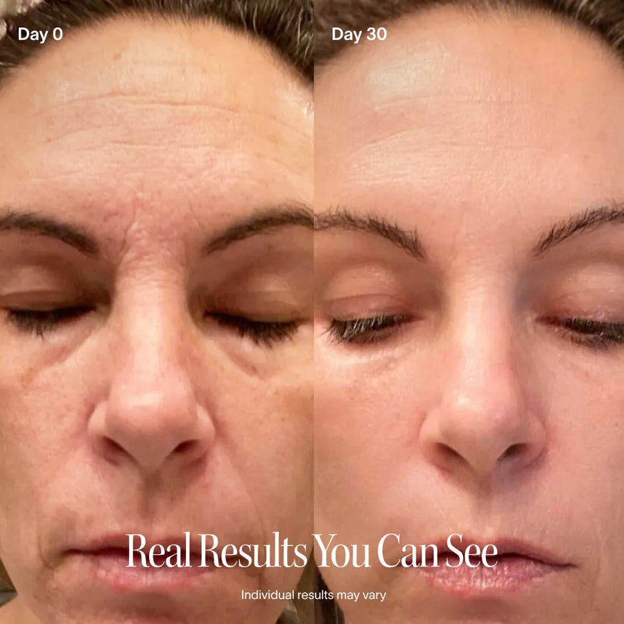 Skinslux 4-in-1 Skincare Wand